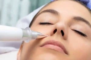 Best Actinic Keratoses Removal 3 Actinic keratoses Twickenham solutions - book in today!