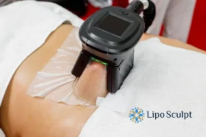 Does Fat Freezing At Home Work? 3 Fat freezing at home from Lipo Sculpt Twickenham